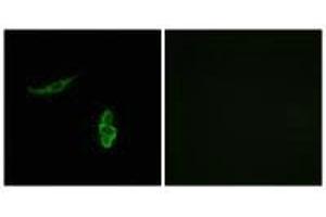 Immunofluorescence analysis of A549 cells, using SCNN1D antibody. (SCNN1D antibody)