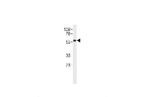 Western Blotting (WB) image for anti-Tumor Protein P53 (TP53) (AA 293-322) antibody (ABIN390204)