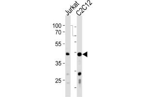 Western Blotting (WB) image for anti-Polymerase (DNA-Directed), delta Interacting Protein 3 (POLDIP3) antibody (ABIN3001314)