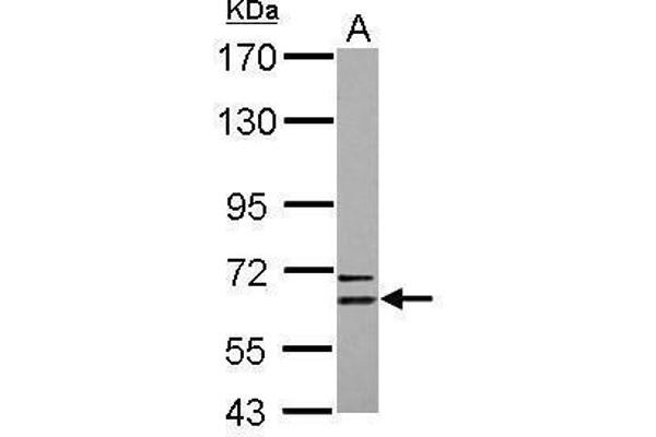 CPNE6 antibody