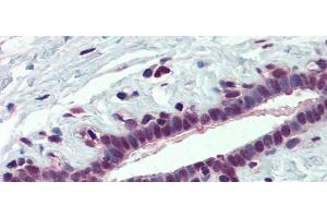 Immunohistochemistry (IHC) image for anti-Poly(rC) Binding Protein 1 (PCBP1) (Middle Region) antibody (ABIN2778971)