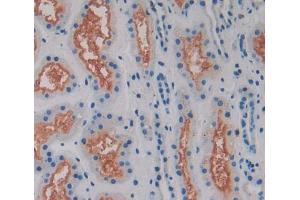 IHC-P analysis of kidney tissue, with DAB staining. (MAN1A1 antibody  (Glu653))