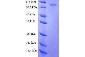 SDS-PAGE (SDS) image for Keratin 6A (KRT6A) (AA 2-564) protein (GST tag) (ABIN5709833) (KRT6A Protein (AA 2-564) (GST tag))
