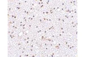 Immunohistochemistry of TOCA-1 in human brain tissue with this product at 2. (FNBP1L antibody  (C-Term))
