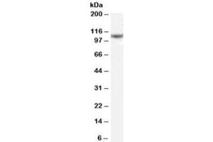 Western blot testing of K562 cell lysate with NCAPH antibody at 0. (NCAPH antibody)