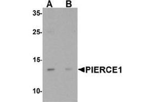 Western blot analysis of PIERCE1 in A20 cell lysate with PIERCE1 Antibody  at 1 µg/mL in (A) the absence and (B) the presence of blocking peptide. (C9ORF116 antibody  (N-Term))
