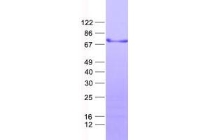 Validation with Western Blot (ZBTB44 Protein (His tag))
