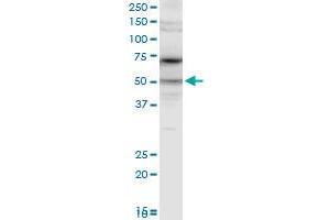 Western Blotting (WB) image for anti-Phenylalanyl-tRNA Synthetase, alpha Subunit (FARSA) (AA 101-201) antibody (ABIN560846)