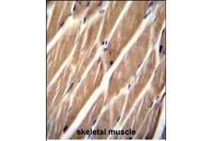 PIP5KL1 Antibody (N-term) (ABIN655244 and ABIN2844847) immunohistochemistry analysis in formalin fixed and paraffin embedded human skeletal muscle followed by peroxidase conjugation of the secondary antibody and DAB staining. (PIP5KL1 antibody  (N-Term))