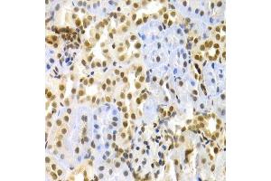 Immunohistochemistry of paraffin-embedded rat kidney using MAPK3 Antibody. (ERK1 antibody  (AA 1-100))