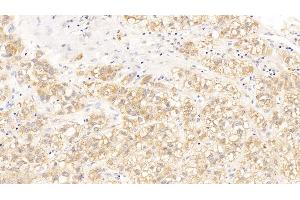 Immunohistochemistry (IHC) image for anti-Cyclin-Dependent Kinase Inhibitor 1A (p21, Cip1) (CDKN1A) (AA 1-164) antibody (ABIN7439048)