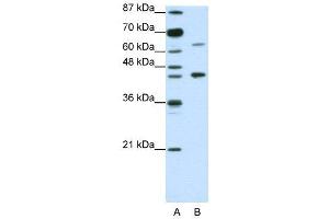 WB Suggested Anti-RARA  Antibody Titration: 1. (Retinoic Acid Receptor alpha antibody  (N-Term))