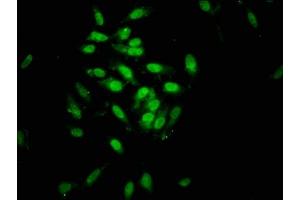 Immunofluorescence staining of Hela cells with ABIN7162487 at 1:133, counter-stained with DAPI. (SIN3B antibody  (AA 705-769))