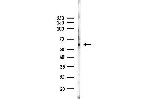 anti-Prolyl 4-Hydroxylase, alpha Polypeptide III (P4HA3) antibody