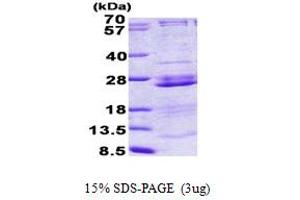 SDS-PAGE (SDS) image for Ribosomal Protein L23A (RPL23A) (AA 1-156) protein (His tag) (ABIN5852978)
