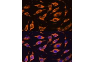 Immunofluorescence analysis of L929 cells using MMP25 antibody (ABIN3023456, ABIN3023457, ABIN3023458 and ABIN6220000) at dilution of 1:100. (MMP25 antibody)