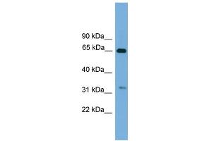 WB Suggested Anti-UBXD3 Antibody Titration: 0. (UBXN10 antibody  (Middle Region))