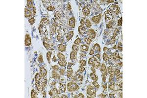 Immunohistochemistry of paraffin-embedded human stomach using UQCRC1 antibody (ABIN5971722) at dilution of 1/100 (40x lens). (UQCRC1 antibody)