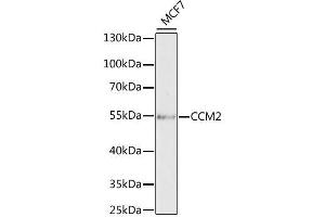 Western blot analysis of extracts of MCF7 cells, using CCM2 antibody. (CCM2 antibody  (AA 1-300))