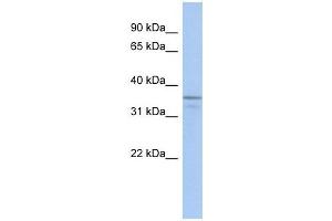UBLCP1 antibody used at 1 ug/ml to detect target protein. (UBLCP1 antibody  (N-Term))