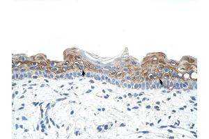DAZ2 antibody was used for immunohistochemistry at a concentration of 4-8 ug/ml to stain Squamous epithelial cells (arrows) in Human Skin. (DAZ2 antibody  (N-Term))