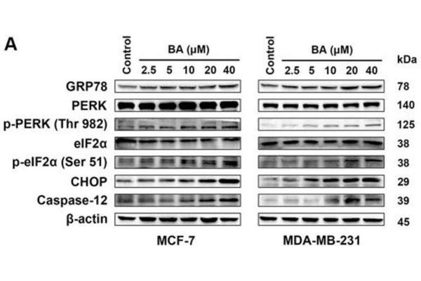 PERK anticorps  (pThr982)