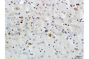 Formalin-fixed and paraffin embedded rat brain tissue labeled with Rabbit Anti-PACAP-38 Polyclonal Antibody (ABIN726215), Unconjugated at 1:200 followed by conjugation to the secondary antibody and DAB staining.