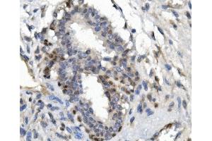 IHC analysis of FOXP1 using anti-FOXP1 antibody (ABIN7602780). (FOXP1 antibody  (C-Term))