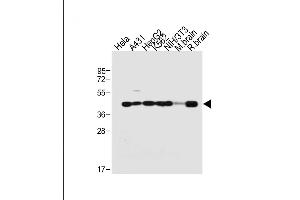 All lanes : Anti-TARDBP Antibody (N-term) at 1:2000 dilution Lane 1: Hela whole cell lysate Lane 2: A431 whole cell lysate Lane 3: HepG2 whole cell lysate Lane 4: K562 whole cell lysate Lane 5: NIH/3T3 whole cell lysate Lane 6: Mouse brain tissue lysate Lane 7: Rat brain tissue lysate Lysates/proteins at 20 μg per lane.