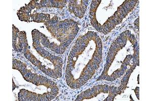 IHC analysis of TMC7 using anti-TMC7 antibody (ABIN7602499). (TMC7 antibody  (AA 8-723))
