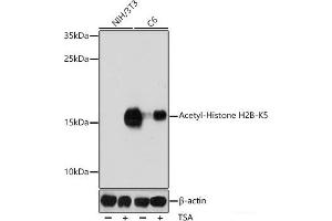 Western blot analysis of extracts of various cell lines using Acetyl-Histone H2B-K5 Polyclonal Antibody at dilution of 1:1000. (Histone H2B antibody  (acLys5))