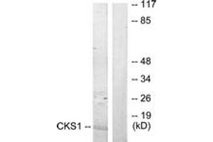 Western Blotting (WB) image for anti-CDC28 Protein Kinase Regulatory Subunit 1B (CKS1B) (AA 10-59) antibody (ABIN2889528) (CKS1 antibody  (AA 10-59))