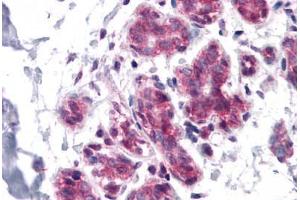 Human Breast: Formalin-Fixed, Paraffin-Embedded (FFPE) (CDC27 antibody  (C-Term))