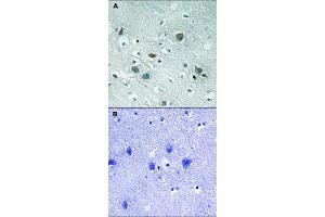 Immunohistochemical staining of human brain tissue by DPYSL2 (phospho T509) polyclonal antibody  without blocking peptide (A) or preincubated with blocking peptide (B) under 1:50-1:100 dilution.