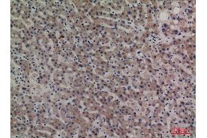Immunohistochemistry (IHC) analysis of paraffin-embedded Human Liver, antibody was diluted at 1:100.