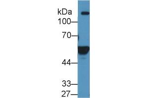 Western blot analysis of Human K562 cell lysate, using Human ALDH1A2 Antibody (1 µg/ml) and HRP-conjugated Goat Anti-Rabbit antibody ( (ALDH1A2 antibody  (AA 1-422))