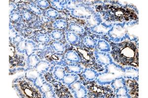 IHC analysis of Icam1 using anti-Icam1 antibody (ABIN7601978). (ICAM1 antibody  (AA 53-537))