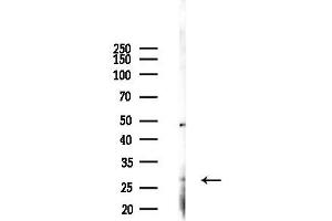 anti-Acidic (Leucine-Rich) Nuclear phosphoprotein 32 Family, Member A (ANP32A) (C-Term) antibody