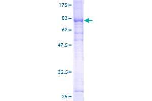 Image no. 1 for Glycerol Kinase 3 Pseudogene (GK3P) (AA 1-553) protein (GST tag) (ABIN1355160) (GK3P Protein (AA 1-553) (GST tag))