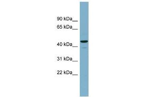 CANT1 antibody used at 1 ug/ml to detect target protein. (CANT1 antibody  (Middle Region))