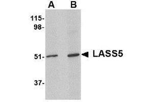 Image no. 1 for anti-LAG1 Homolog, Ceramide Synthase 5 (LASS5) (N-Term) antibody (ABIN341704) (LASS5 antibody  (N-Term))