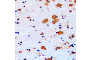 Immunohistochemistry (IHC) image for anti-Cyclin-Dependent Kinase Inhibitor 1B (p27, Kip1) (CDKN1B) (C-Term) antibody (ABIN7295234)