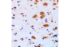 Immunohistochemical analysis of p27 Kip1 staining in human brain formalin fixed paraffin embedded tissue section.