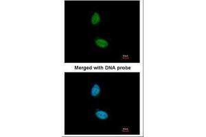 ICC/IF Image Immunofluorescence analysis of paraformaldehyde-fixed HeLa, using ZNF134, antibody at 1:200 dilution. (ZNF134 antibody)