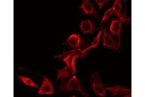ABIN6275548 staining HeLa by IF/ICC. (PPP2R1B antibody  (C-Term))