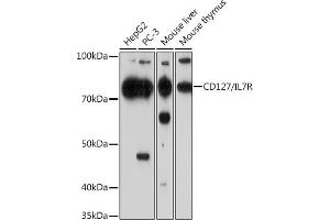 Western blot analysis of extracts of various cell lines, using CD127/IL7R Rabbit mAb (ABIN7268005) at 1:1000 dilution. (IL7R antibody)
