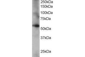 Western Blotting (WB) image for anti-Coronin, Actin Binding Protein, 1C (CORO1C) (C-Term) antibody (ABIN2465550) (CORO1C antibody  (C-Term))