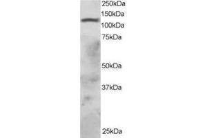 Image no. 1 for anti-Ring Finger Protein 31 (RNF31) (C-Term) antibody (ABIN374257) (RNF31 antibody  (C-Term))