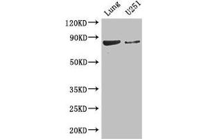 Western Blot Positive WB detected in: Mouse lung tissue, U251 whole cell lysate All lanes: YTHDC1 antibody at 3. (YTHDC1 antibody  (AA 89-153))