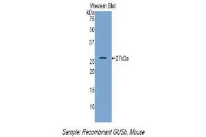 Western Blotting (WB) image for anti-Glucuronidase, beta (GUSB) (AA 451-648) antibody (ABIN1859100) (Glucuronidase beta antibody  (AA 451-648))